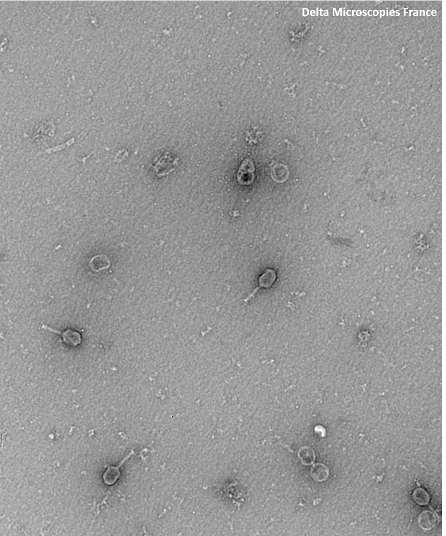 phage T6 2
