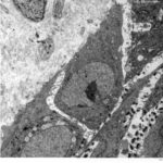 result of stain with uranyless aqueous