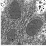 result of hepatocyte fixative used uranyless aqueous