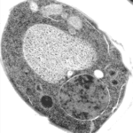 application of uranyless solution contrast