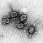 microscopy picture of a phage t6 uranyless result