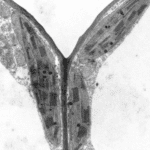 micrscopy eletronic result of stain use