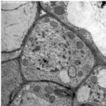 racine de rosier stain with uranyless aqueous