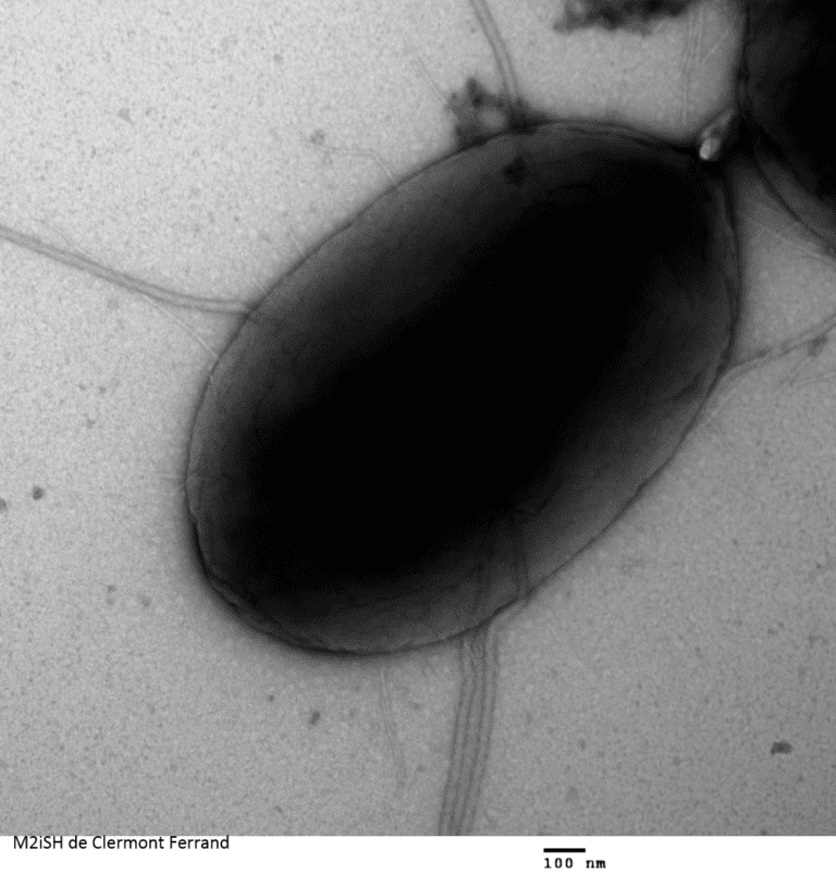 bacterie negative staining