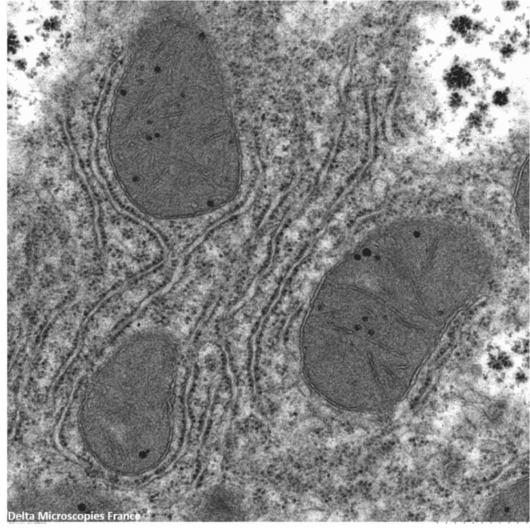 kidney observation in electronic microscopy