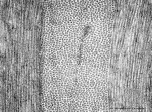 alcohol stain microscopie picture