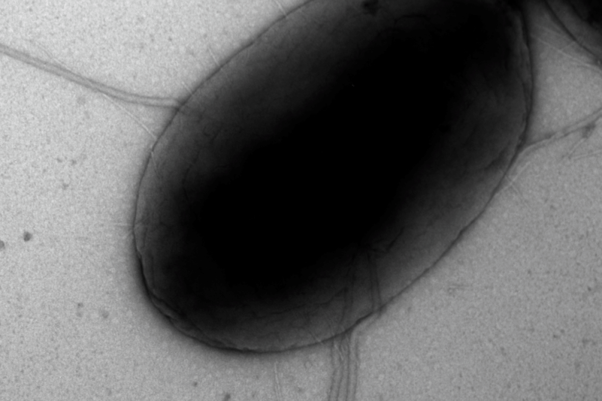 bacterie negative staining