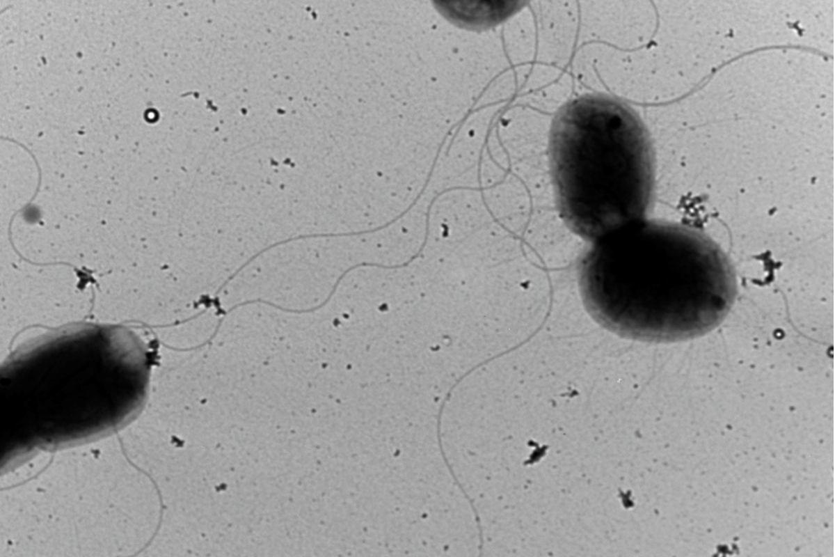 bacterie negative staining