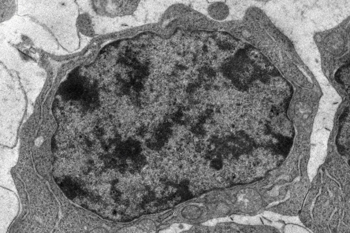 Delta-cellule-folliculaire