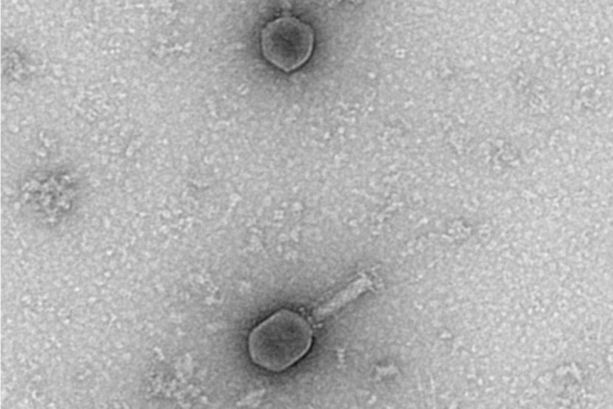 negative staining phage t6