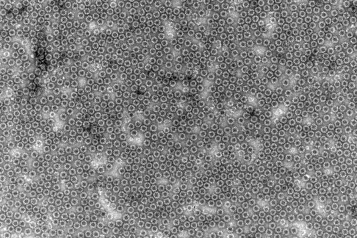 corona observation cells with negative staining 2